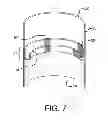 Fig. 08 - Endoluminal prosthetic conduit systems and method of coupling