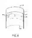 Fig. 09 - Endoluminal prosthetic conduit systems and method of coupling