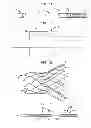 Fig. 02 - System to assist in the release of a collapsible stent from a delivery device