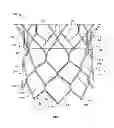 Fig. 02 - Commissure attachment feature for prosthetic heart valve