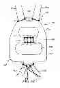Fig. 07 - Commissure attachment feature for prosthetic heart valve