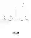 Fig. 07 - Intraocular Lens with Accommodation
