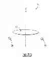 Fig. 09 - Intraocular Lens with Accommodation