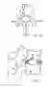Fig. 08 - METHODS OF REPAIRING HERNIATED SEGMENTS IN THE DISC