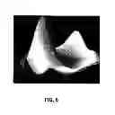 Fig. 07 - METHODS AND COMPOSITIONS FOR ARTICULAR RESURFACING