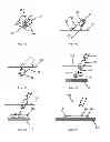 Fig. 02 - NOVEL BIOLOGICAL IMPLANT COMPOSITIONS, IMPLANTS AND METHODS