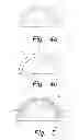 Fig. 06 - Ceramic monoblock implants with osseointegration fixation surfaces