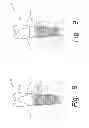Fig. 08 - Ceramic monoblock implants with osseointegration fixation surfaces