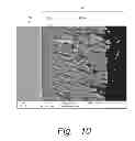 Fig. 09 - Ceramic monoblock implants with osseointegration fixation surfaces