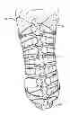 Fig. 01 - Adjustable prosthetic limb system