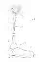 Fig. 01 - Lower leg prosthesis