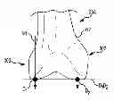 Fig. 01 - Generation of a computerized bone model representative of a pre-degenerated state and useable in the design and manufacture of arthroplasty devices