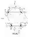 Fig. 20 - Generation of a computerized bone model representative of a pre-degenerated state and useable in the design and manufacture of arthroplasty devices
