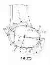 Fig. 27 - Generation of a computerized bone model representative of a pre-degenerated state and useable in the design and manufacture of arthroplasty devices