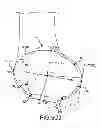 Fig. 28 - Generation of a computerized bone model representative of a pre-degenerated state and useable in the design and manufacture of arthroplasty devices