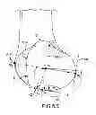 Fig. 29 - Generation of a computerized bone model representative of a pre-degenerated state and useable in the design and manufacture of arthroplasty devices