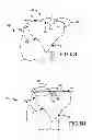 Fig. 31 - Generation of a computerized bone model representative of a pre-degenerated state and useable in the design and manufacture of arthroplasty devices