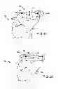 Fig. 32 - Generation of a computerized bone model representative of a pre-degenerated state and useable in the design and manufacture of arthroplasty devices
