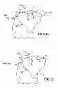 Fig. 33 - Generation of a computerized bone model representative of a pre-degenerated state and useable in the design and manufacture of arthroplasty devices