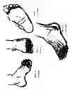 Fig. 02 - Toe Shield Glove (TSG)