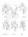 Fig. 06 - Firearm leaner