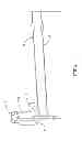 Fig. 04 - Binary track safety traverse system reconfigurable to provide safe trajectories over a wide range of inclinations