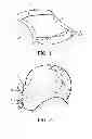 Fig. 02 - Device and method for guiding latch-on