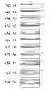 Fig. 02 - Dry etching method