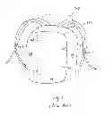 Fig. 02 - Compression system for backpack