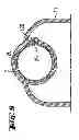 Fig. 07 - PROPELLANT HOLDER FOR AN EXPLOSION-DRIVEN SETTING TOOL AND AN EXPLOSION-DRIVEN SETTING TOOL