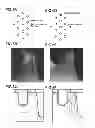 Fig. 06 - Method and system of evaluating distribution of lattice strain on crystal material