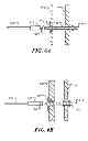 Fig. 05 - Railing support post with threaded receivers