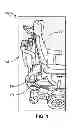Fig. 02 - Wheelchair backrest assembly