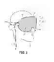 Fig. 02 - Personal alarm system
