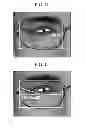 Fig. 07 - METHOD FOR MEASURING PARAMETERS FOR MANUFACTURING SPECTACLE LENS AND DEVICE FOR REALIZING THE SAME