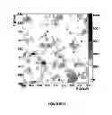 Fig. 07 - Upstream direct x-ray detection