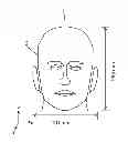 Fig. 01 - BTE hearing aid having two driven antennas
