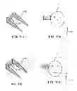 Fig. 08 - BTE hearing aid with an antenna partition plane