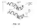 Fig. 09 - Online anti-feedback system for a hearing aid