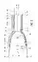 Fig. 03 - CIC Hearing Aid
