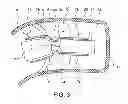 Fig. 04 - CIC Hearing Aid