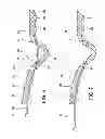 Fig. 07 - CIC Hearing Aid