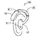 Fig. 01 - Hearing assistance system with own voice detection