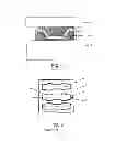 Fig. 02 - Rolling element cage