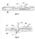 Fig. 03 - Crush-resistant fiber optic cable
