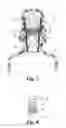 Fig. 05 - Roll-on applicator