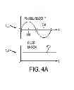 Fig. 08 - Hybrid tensioning of riser string