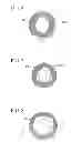 Fig. 04 - Turbocharger and method of manufacturing floating bush