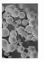 Fig. 06 - Oxidized cellulose miczrospheres including visualization agents