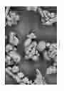 Fig. 07 - Oxidized cellulose miczrospheres including visualization agents